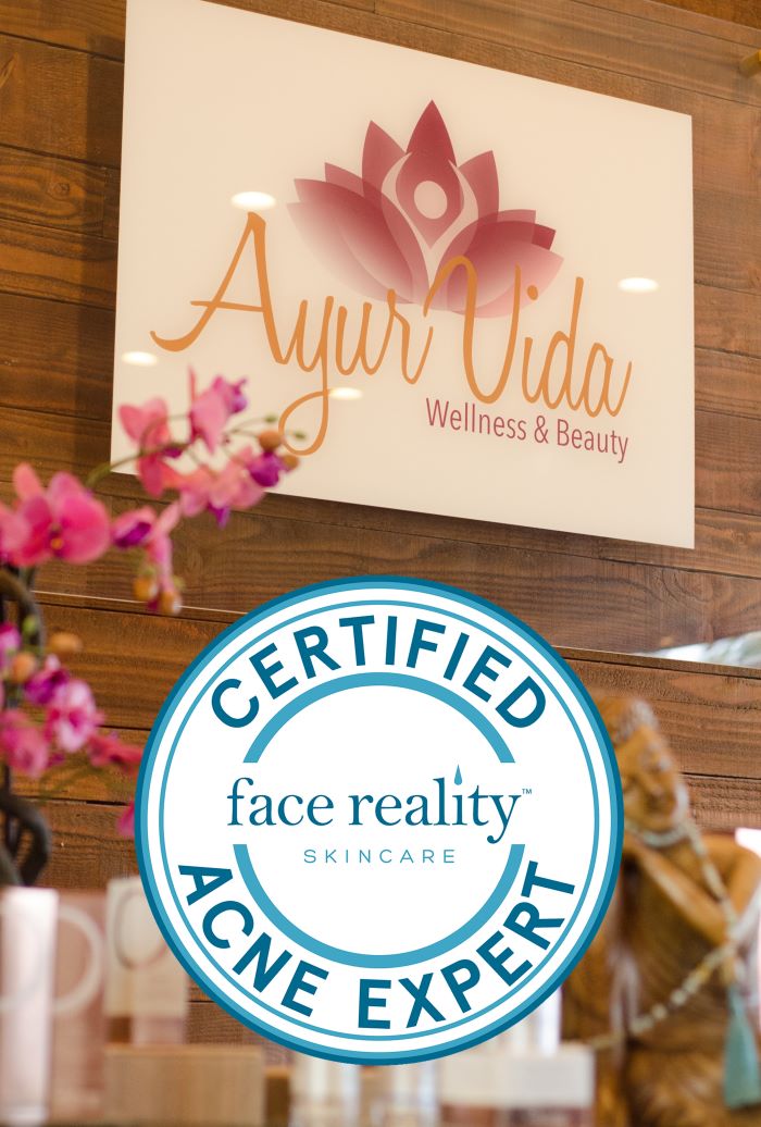 acne specialist in san diego CA