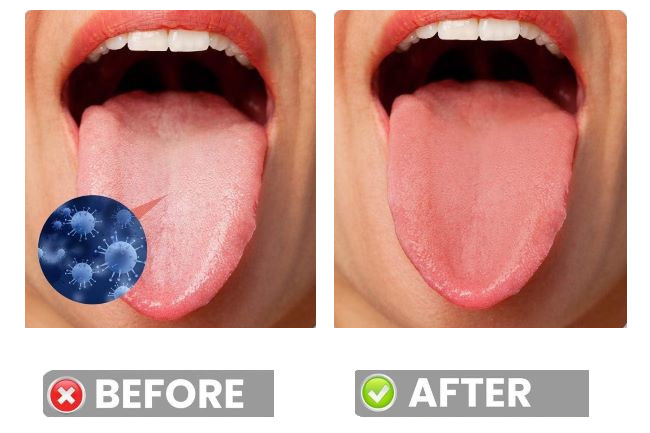 Tongue Scraping before and after