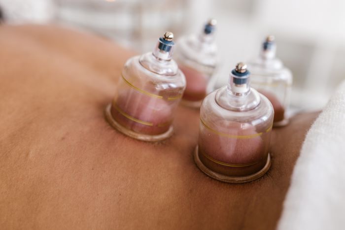EXPERIENCE CUPPING THERAPY MASSAGE