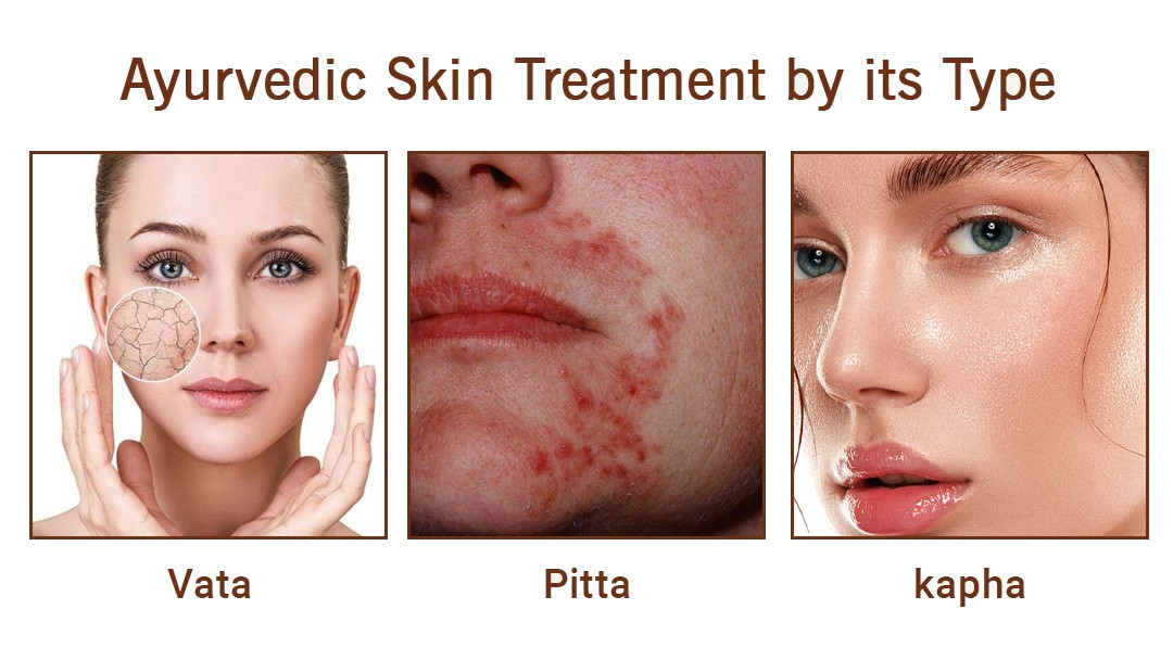 UNDERSTANDING YOUR SKIN TYPE