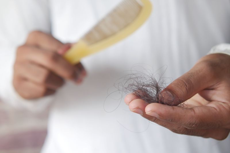 Why Is Your Hair Falling Out? And What Actually Helps